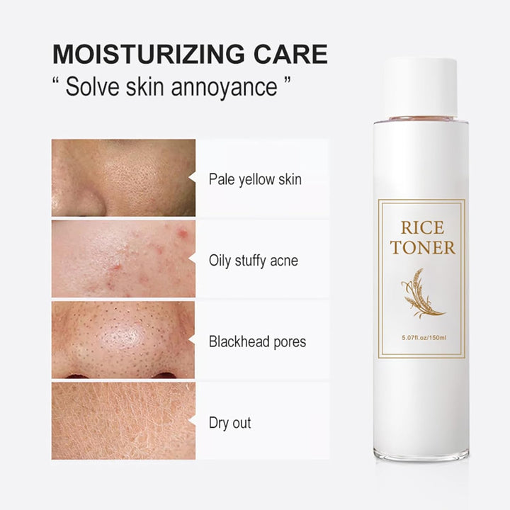 I m From Rice Toner , Rice Extract, Niacinamide - Fashnito