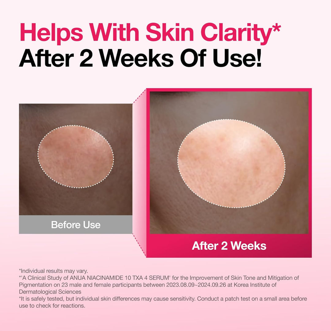 Anua Niacinamide 10 TXA 4 Serum , Fade Spots, Even Tone, Strengthen Skin - Fashnito