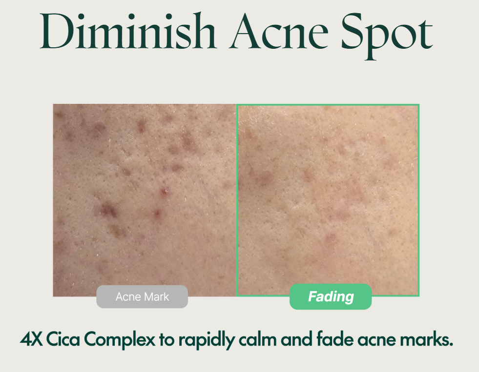PURITO Wonder Releaf Centella Serum - helps diminish acne spots